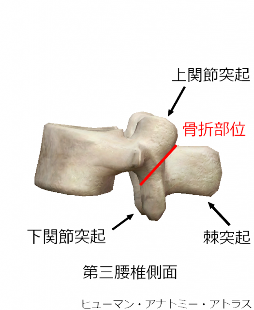 ��O���ő���